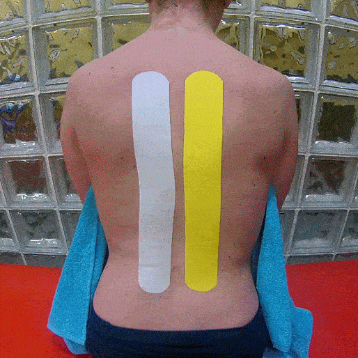 Arrugas Vendaje Neuromuscular Escuela Quiros